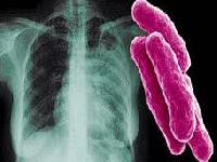 Хіміки підійшли ближче до позбавлення від туберкульозу