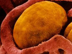 Дослідники знайшли спосіб зупинити набір ваги