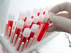 Унікальний тест може виявити ендометріоз по крові