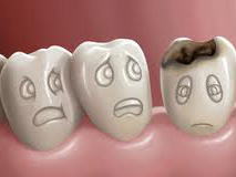 Вчені досліджували середньовічні випадки хвороб зубів і ясен