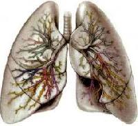 Відкриття: в легенях живуть клітини, які не вбиває вірус грипу