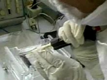 Неврологи виявили ключовий для розвитку тривожності елемент