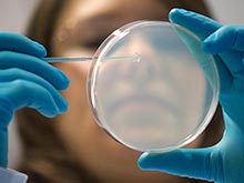 Інсульти та бактерії в ротовій порожнині пов'язані, показав аналіз