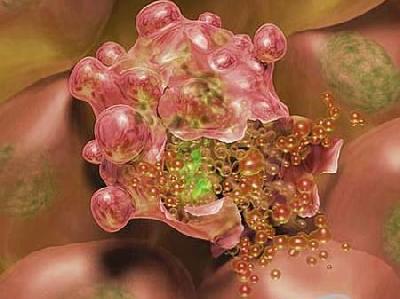 Вмираючі клітини виявилися справжнім порятунком від раку