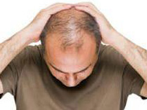 Дослідники виявили несподівані ліки від облисіння