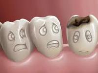 Вчені досліджували середньовічні випадки хвороб зубів і ясен